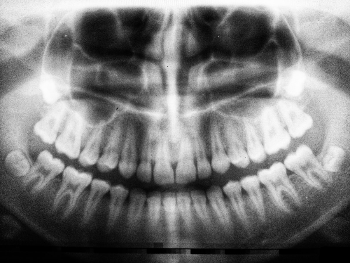 Radiografia panoramica dental digital